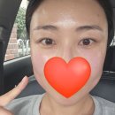 사천 피부관리 보담뷰티 사천리프팅 라인이 너무 예뻐졌어요