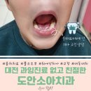 대전 &#39;도안소아치과의원&#39; 내돈내치 치과 무서워하는 아이 치료 후기, 과잉진료 없고 친절함, 노은갔다가...