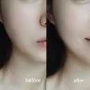 리앤스킨 | 리앤밤 스피듀얼샷 피부홈케어 뷰티 디바이스 추천 셀프 피부관리 방법
