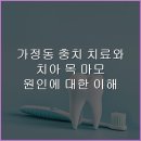 가정백세플란트치과의원 | 가정동 충치 치료와 치아 목 마모 원인에 대한 이해