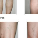 아나파적맥통증의원 이미지