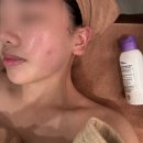 마산 피부관리 , 에르모소 프라이빗한 트로이필 관리 후기
