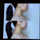 삼계동물병원 | [김해 삼계 에스테틱] 수에스테틱 : 티리온-X로 완성하는 1:1 맞춤 페이스 리프팅 후기