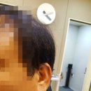 분당연세보청기 이미지