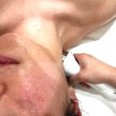 웨이브타운 | 분당 서현역피부관리 디율에스테틱 써마웨이브 관리 후기