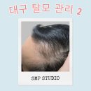 까까머리 헤어샵 - 창녕군 | 동성로 탈모 관리 SMP 스튜디오 대구점 두피 케어까지!
