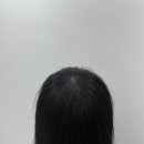 탈모왕 광주점 이미지