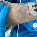 이노메드 이미지