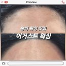 디테일헤어 - 천안시 동남구 | 송파왁싱 추천 디테일이 살아있는 [어거스트왁싱] 헤어라인+인중 대만족 후기!