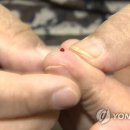 ﻿'발암추정물질' 당뇨약 복용 26만명 어쩌나.."임의 중단 말아야"﻿ 이미지