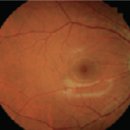 Kowa Nonmyd 7 Fundus Camera 이미지