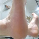 더케어(The Care) 이미지