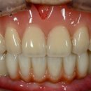 인천 덴쳐기공소 이미지