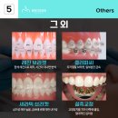 열린치과기공소 이미지