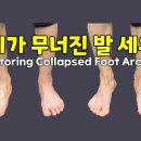 마름모코어 시즌 3 -77 ] 아치가 무너진 발 살리기 Restoring Collapsed Foot Arches 이미지