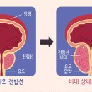 화장실 걱정에 여행 망치지 않으려면... &#39;전립선&#39; 건강부터 확인해야 이미지