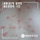 설성반점 이미지