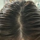 바이오하나주식회사 | 카론바이오 C3 샴푸 후기산후탈모로 예민해진 두피에 순하게