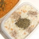 서울의원 | 땡큐서울의원 이하선종양, 침샘종양 수술 후기 / 1인실 1박2일 입원