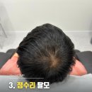 노스탈