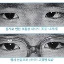 시력이란? 원시 원인 고도근시 난시 복시 약시 이미지