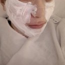 이피부과의원 | [보스피부과의원 쥬베룩 후기] 압구정피부과 쥬베룩볼륨 1병 시술 내돈내산 리얼 후기!!!(feat 무통가스...