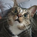 위성정형외과의원 | 🎊축하드립니다🎊 종아리 힘줄 파열 당첨~!