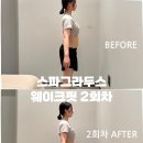 스파그라두스 양산에스테틱 웨이크핏 복부관리 2회차후기