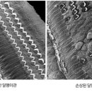 우리소리보청기 이미지