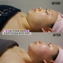서윤피부맑음 네이버블로그
