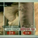 해독센터 이미지