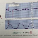 소사로3L | [간호국가고시/ 병원필기시험] 여성간호학 기출 오답 3회