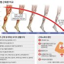 연령별 근육량 비교 이미지