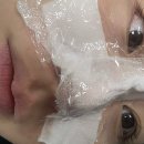 11215-구의3-401 | 구의역 모공전문 피부샵 코피다에서 블랙헤드 박멸