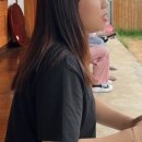 다나메디칼 | 30대 치아 교정 끝 3년 후기 토끼이빨 돌출형입
