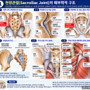 천장관절이 틀어지면 허리와 엉덩이가 아플까요? 천장관절 가동술과 골반통증의 해부학적 원리. 이미지