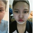 헬레나의원 네이버블로그