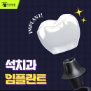 석치과의원 이미지