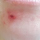 주식회사 바른메디 이미지