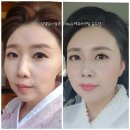 인셀덤 동수원 | 인셀덤 엑티브크림 찐후기!-송편 빚은듯 볼륨빵빵 예쁜 얼굴형 만드는 방법