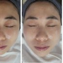 미랑에스테틱 네이버블로그