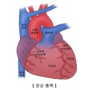 &#34;급성 &#39;심근경색증&#39;이란&#34;＜2024.02.28(수)＞ 이미지