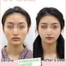 악안면 수술[maxillofacial surgery] 이미지