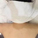 역삼-1328 | 더올슬림 강남점｜강남승모근관리 올핏 관리로 상체체라인 정리 후기