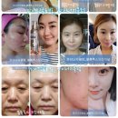 파이진 명품피부