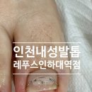 레푸스인하대역점 내성발톱 무좀발톱 발각질 문제성발 | 인천내성발톱 찾다가 간 레푸스 인하대역점