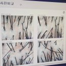 합정두피관리 샵 담혜원 리얼 후기