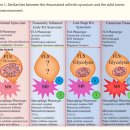 류마티스 관절염 기전탐구 .. 활막세포, metabolic reprogramming, 염증의 증폭, 유지.. 이미지