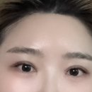 보라매피부관리 디또뷰티 목 두꺼운 게 콤플렉스 고치고 놀란 후기