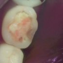 성복정원치과의원 이미지